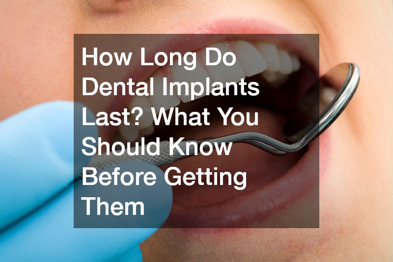 How Long Do Dental Implants Last? What You Should Know Before Getting Them